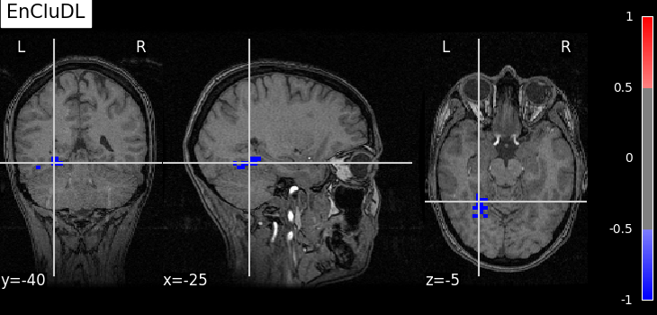 plot fmri data example