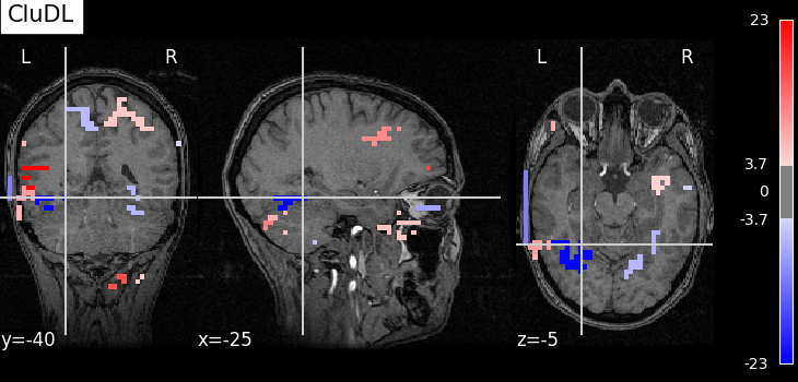 plot fmri data example