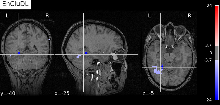 plot fmri data example