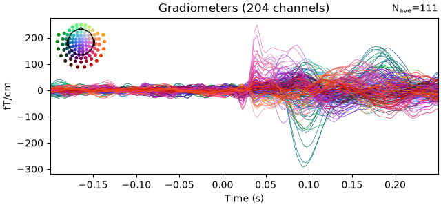 Gradiometers (204 channels)