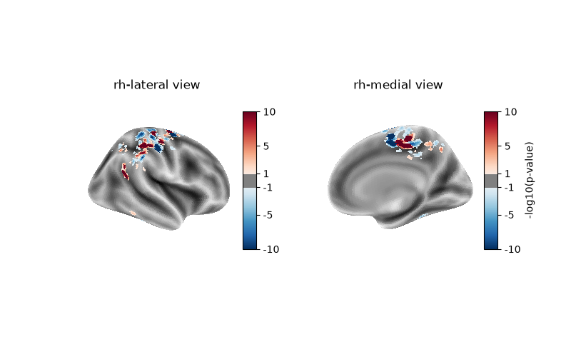 rh-lateral view, rh-medial view